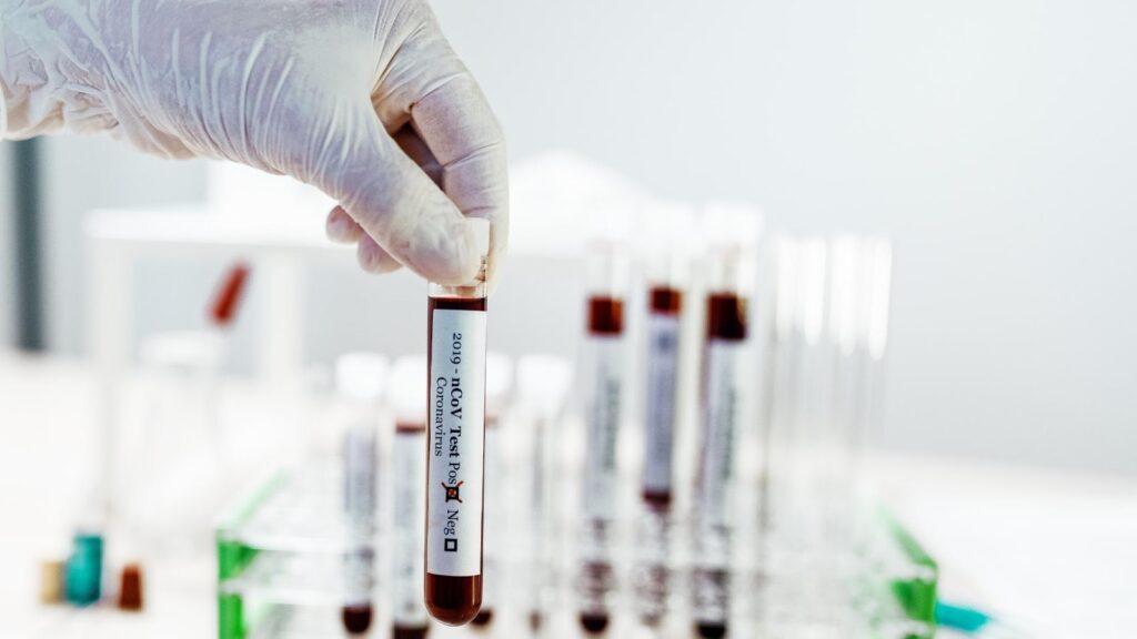 Frascos de coleta de sangue destinados aos testes de DNA.
